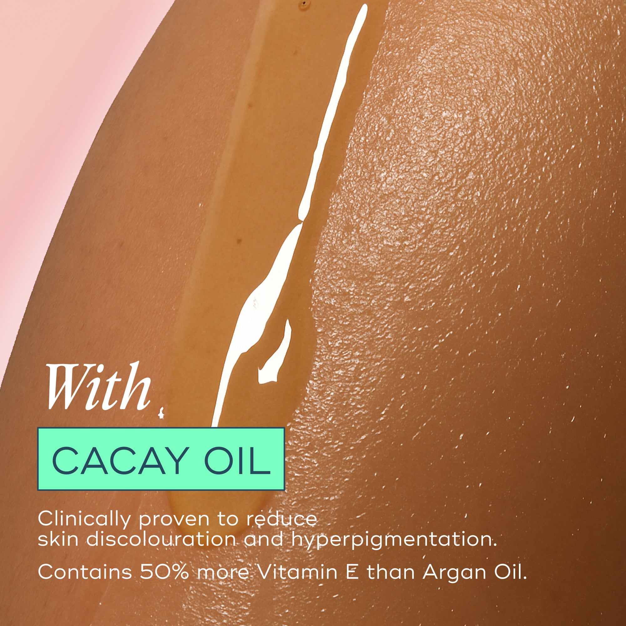 The Skin Support Oil - For Stretch Marks, Hyperpigmentation + Uneven Skin Texture