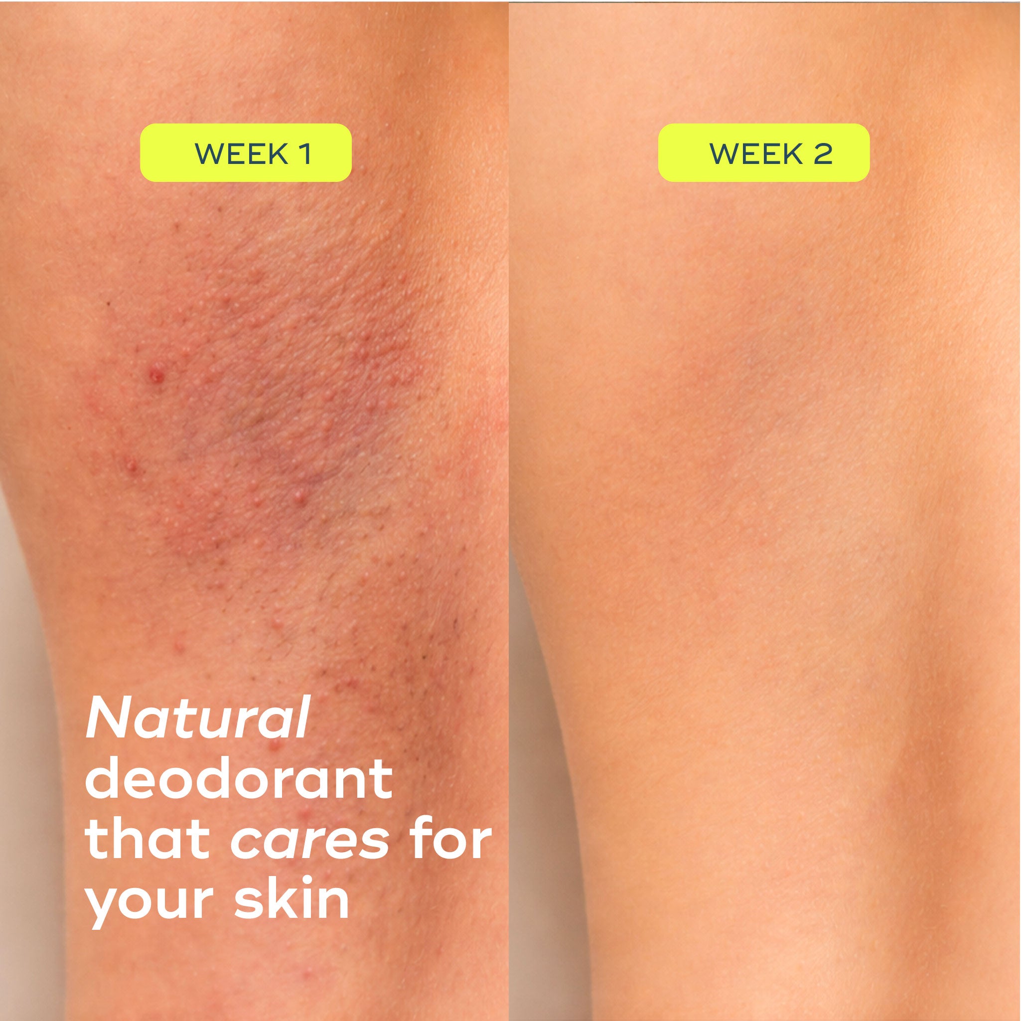 The All Over Deodorant™- Cooling Water Lily + Fresh Citrus