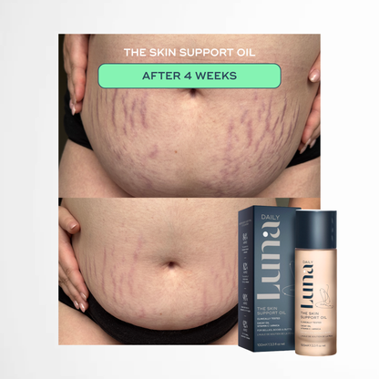 The Skin Support Oil - For Stretch Marks, Hyperpigmentation + Uneven Skin Texture