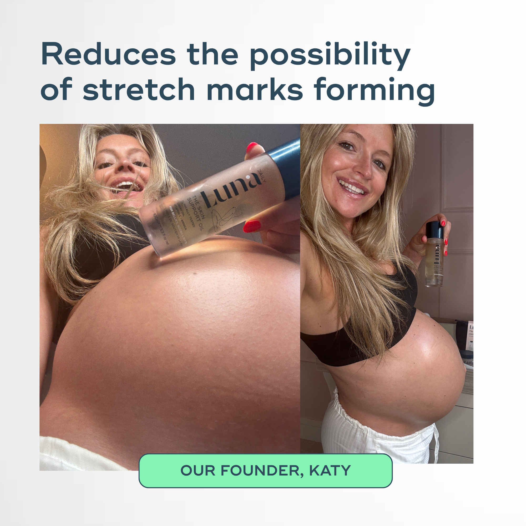 The Skin Support Oil - For Stretch Marks, Hyperpigmentation + Uneven Skin Texture