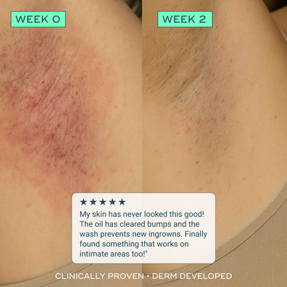 The Hydrating Everything Shower