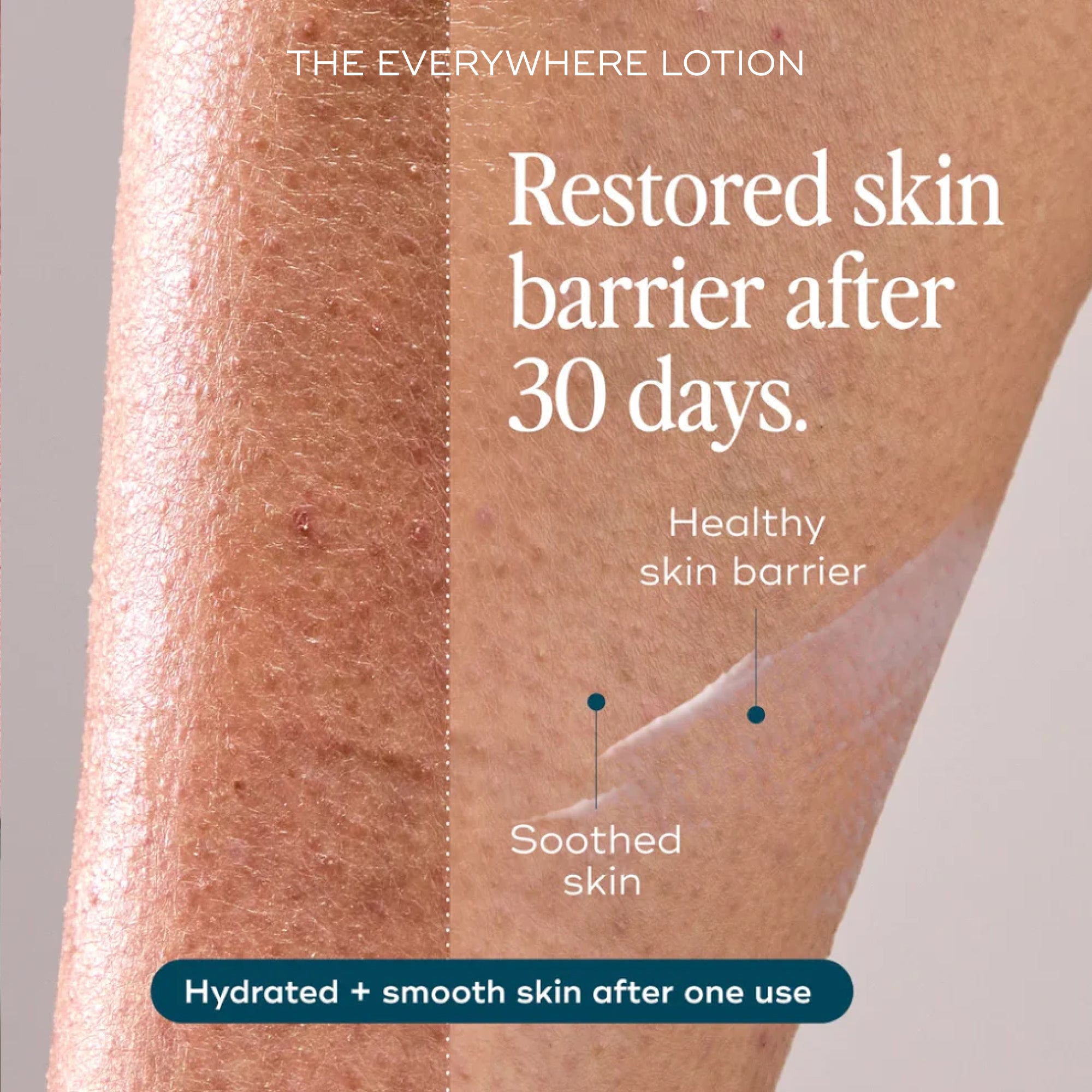 Smooth Skin Saviours - Rid Ingrowns, Redness + Bumps in 2 weeks (+FREE Lotion worth £20)