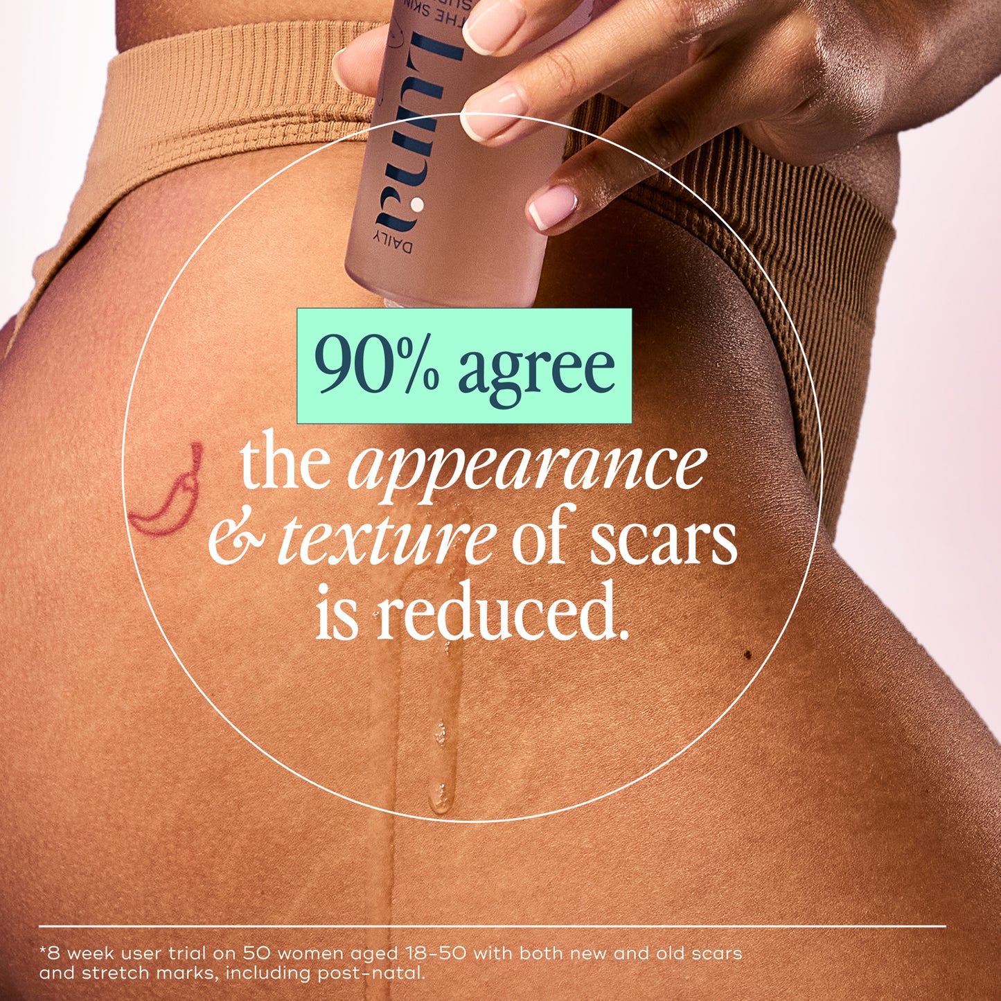 The Skin Support Oil - For Stretch Marks