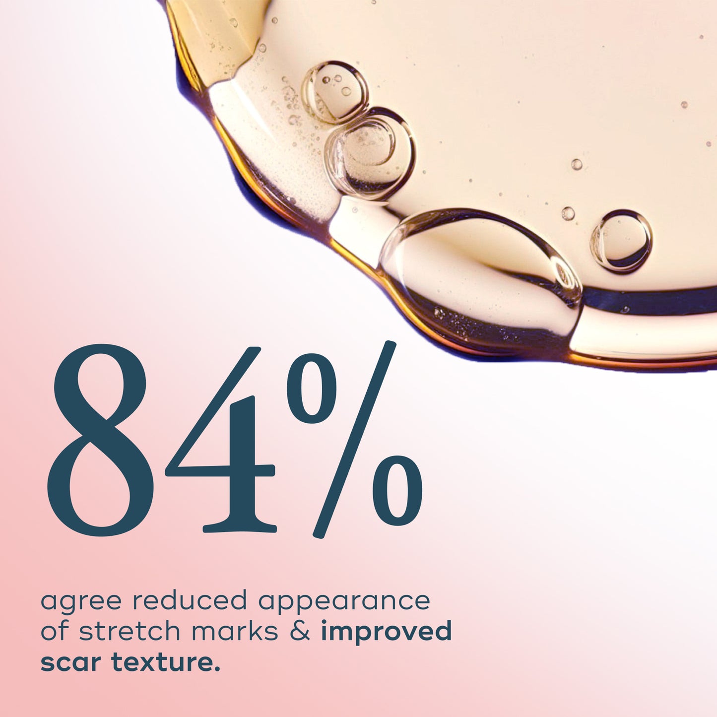 The Skin Support Oil - For Stretch Marks
