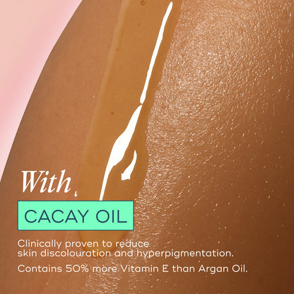 The Skin Support Oil - For Stretch Marks